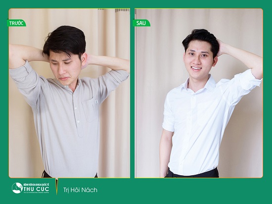 Điều trị hôi nách tại Thu Cúc Sài Gòn sẽ giúp bạn tự tin hơn rất nhiều trong cuộc sống (Lưu ý: Kết quả tùy thuộc cơ địa mỗi người)