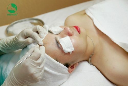 trị mụn