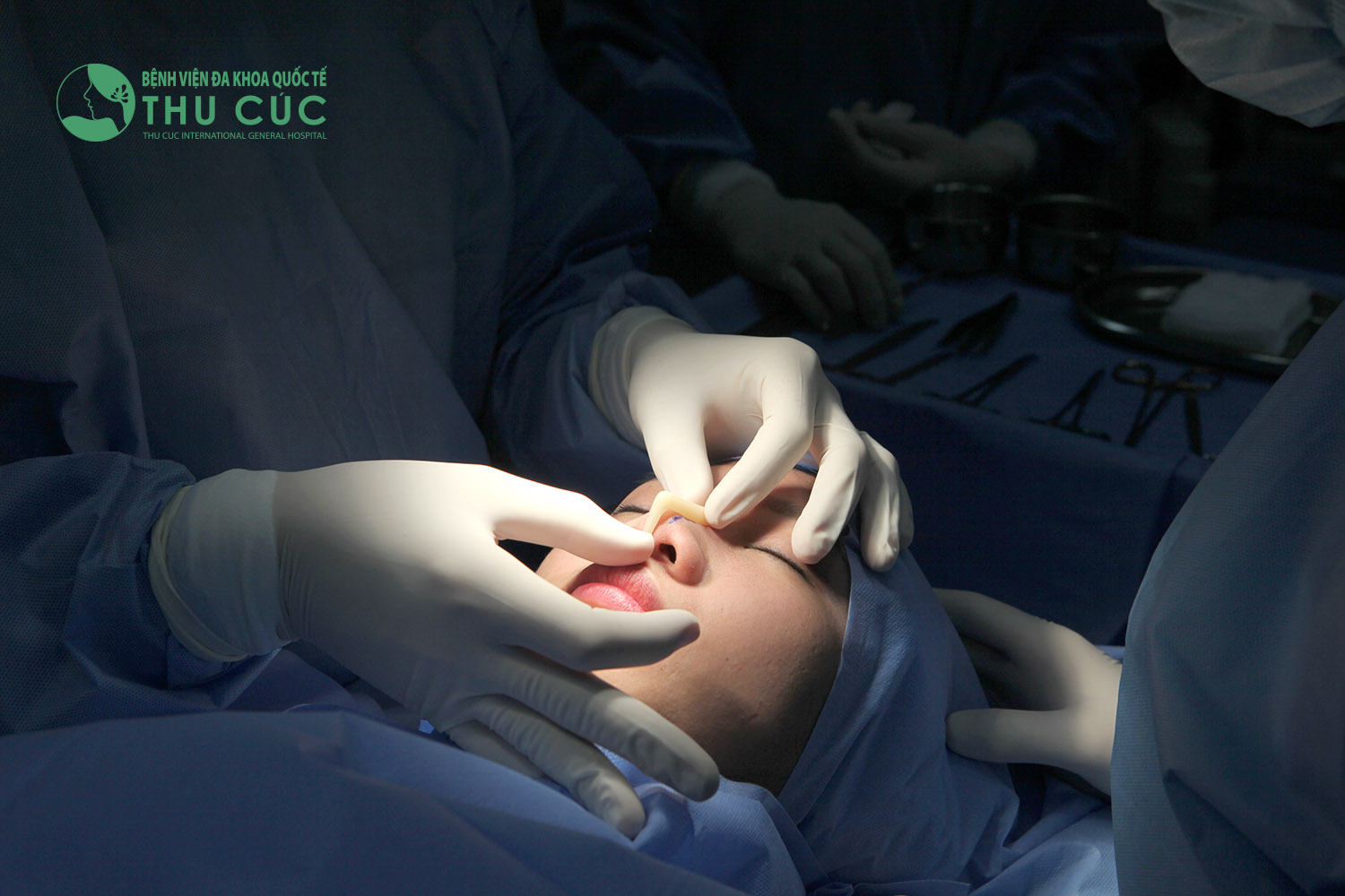 Nâng mũi bọc sụn