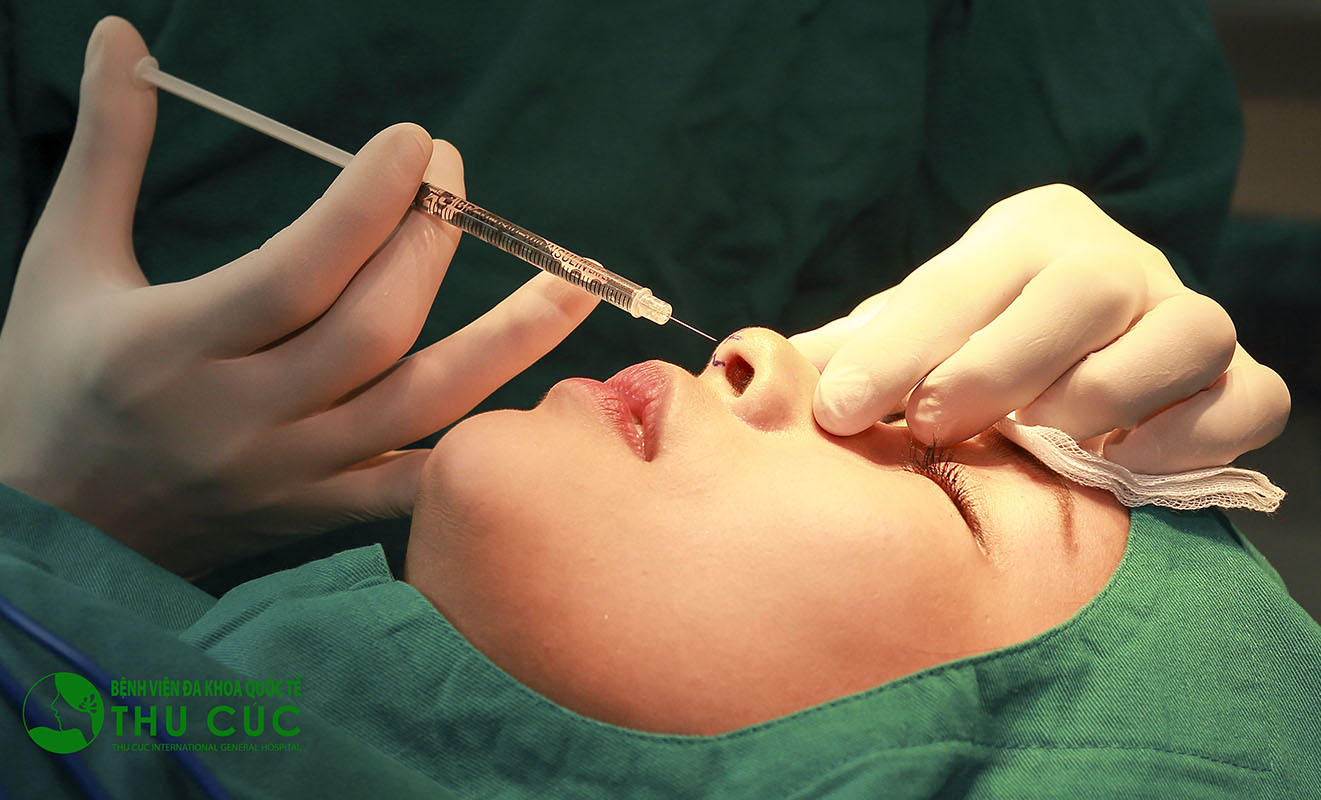 Nâng mũi bằng các phương pháp làm đầy nói chung đều vô hại và giúp nhanh chóng định hình một dáng mũi cao không cần phẫu thuật.
