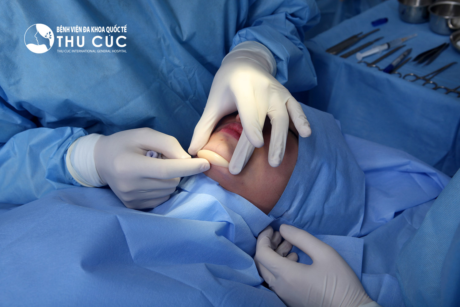 Toàn bộ quy trình phẫu thuật thẩm mỹ cằm tại Thu Cúc Sài Gòn đều được thực hiện theo đúng tiêu chuẩn an toàn của Bộ Y tế
