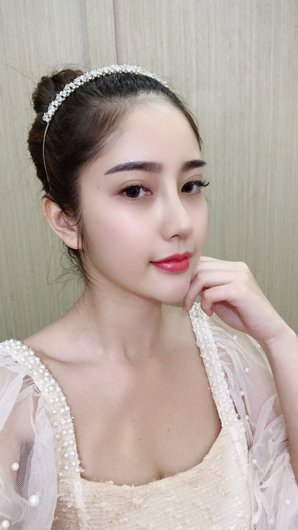 Sau 1 tháng dáng mũi bạn sẽ đẹp tự nhiên như ý