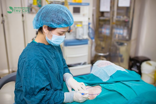 Cắt tuyến mồ hôi nách là giải pháp điều trị an toàn, triệt để