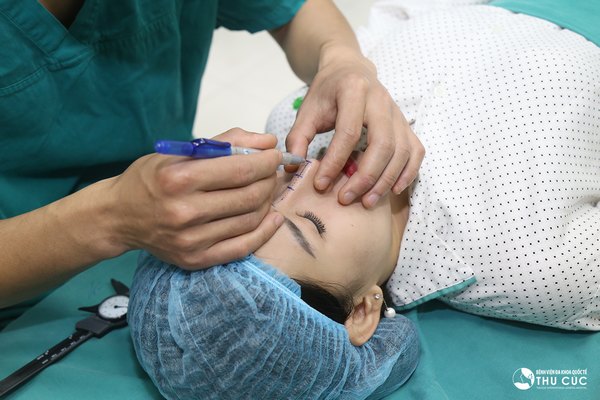 Tại những địa chỉ thẩm mỹ uy tín, kết quả nâng mũi sẽ được duy trì dài lâu
