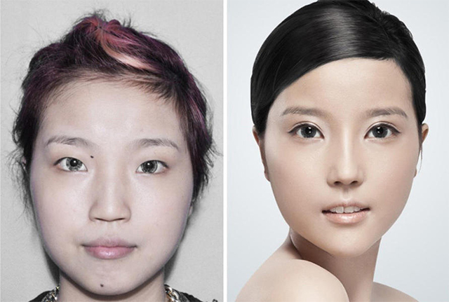 Huang Silan là một ca sĩ phòng trà 20 tuổi. Huang đã trải qua phẫu thuật nâng mũi, điều trị laser cho các nốt tàn nhang trên khuôn mặt. Giờ đây, không ai nhận ra Huang chính là cô gái có chiếc mũi nhiều khiếm khuyết ngày xưa. 