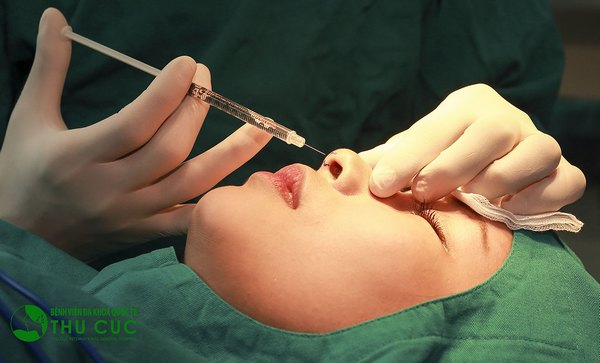 Gây tê là kỹ thuật được sử dụng chính khi nâng mũi