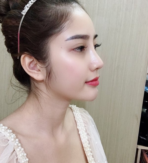 Để sở hữu dáng mũi đẹp như ý thì việc lựa chọn địa chỉ thẩm mỹ uy tín rất quan trọng