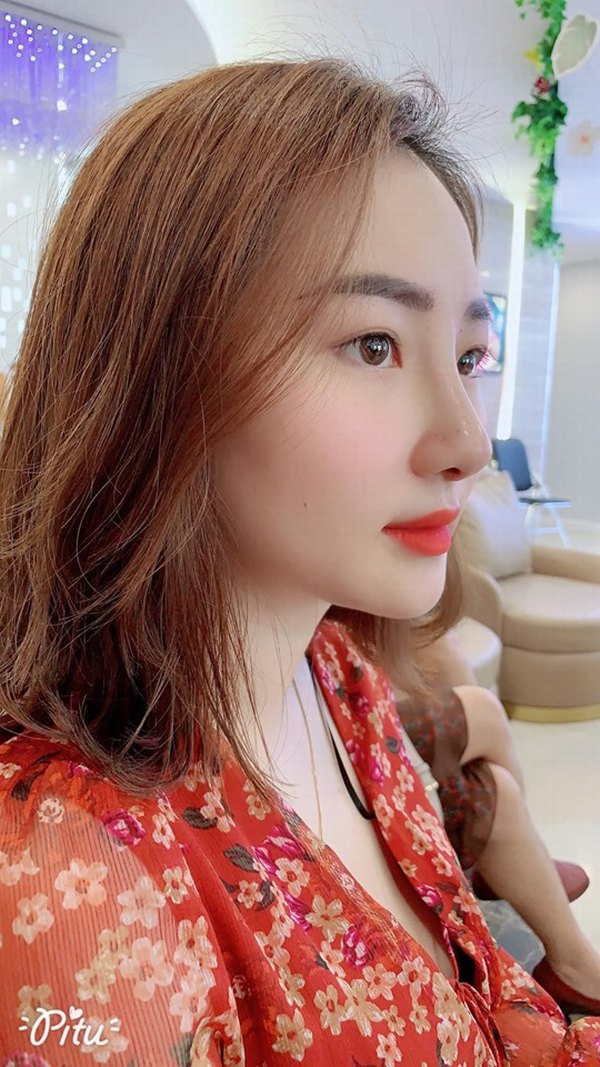 Dáng mũi Sline là dáng mũi được đánh giá là phù hợp nhất với người Việt Nam