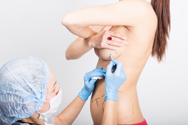 Nâng ngực bằng mỡ tự thân là giải pháp làm đẹp toàn diện