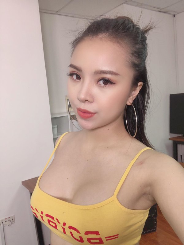 Nâng ngực tại địa chỉ thẩm mỹ uy tín sẽ đảm bảo an toàn và đem lại hiệu quả thẩm mỹ cao
