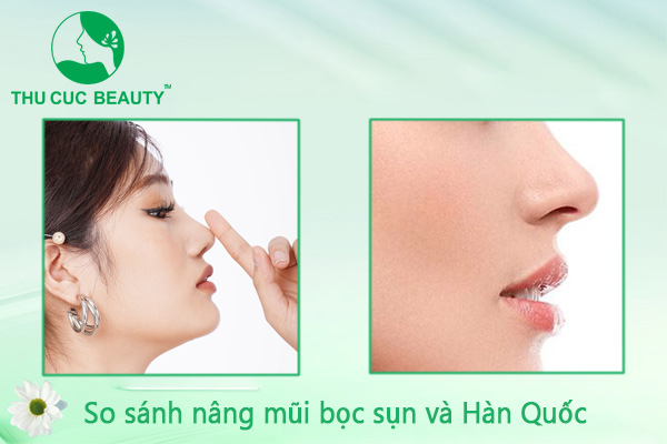 So sánh phương pháp nâng mũi bọc sụn và nâng mũi Hàn Quốc