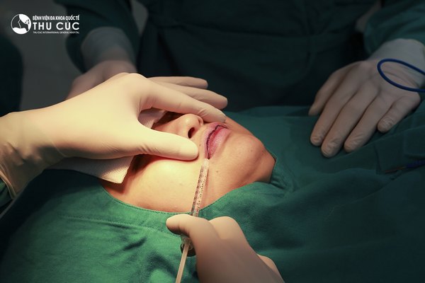 Phẫu thuật tạo hình môi trái tim tại Thu Cúc được thực hiện nhanh chóng và nhanh hồi phục