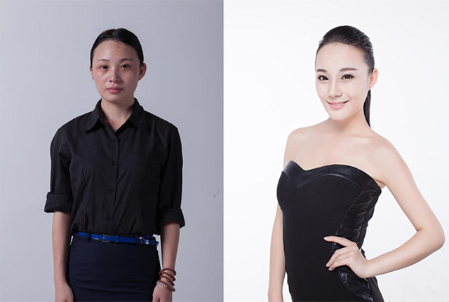 Yan Xu là một cô gái 22 tuổi làm nghề kinh doanh. Sau khi phẫu thuật sửa mũi, điều trị da thì cô đã hóa thành một thiếu nữ trẻ trung, năng động và xinh đẹp.