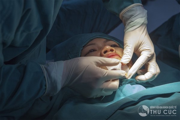 Phẫu thuật tạo cằm chẻ tại Thu Cúc  không gây ra ảnh hưởng gì đến sức khỏe