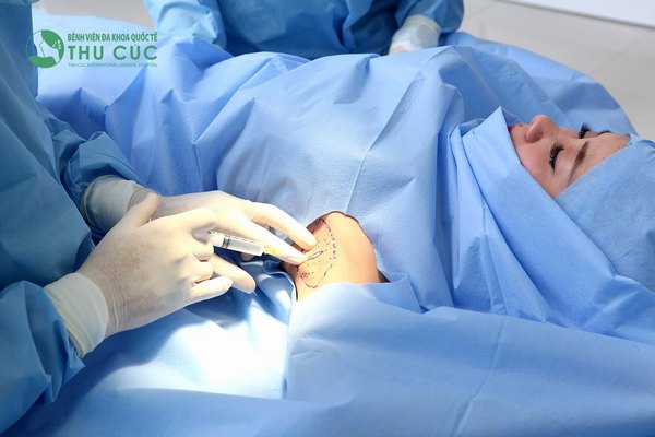 Tiêm botox trị hôi nách