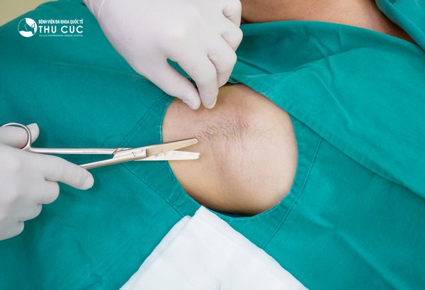 Quy trình phẫu thuật được diễn ra bài bản, chuyên nghiệp, an toàn