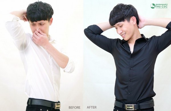 Hôi nách gây ra rất nhiều trở ngại trong cuộc sống