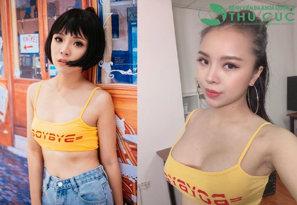 Diễn viên Liên Tít lột xác quyến rũ chết người sau khi nâng ngực tại Thu Cúc