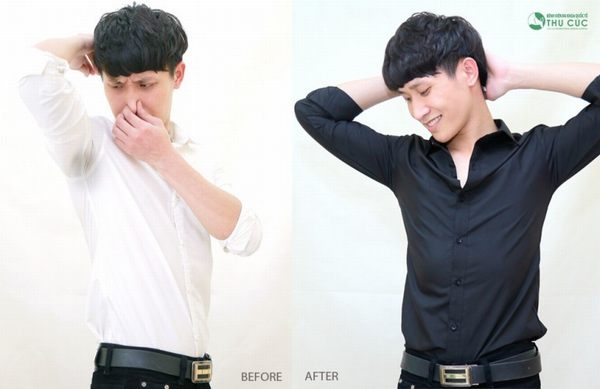Sau khi loại bỏ mùi hôi nách bạn sẽ tự tin hơn trong cuộc sống