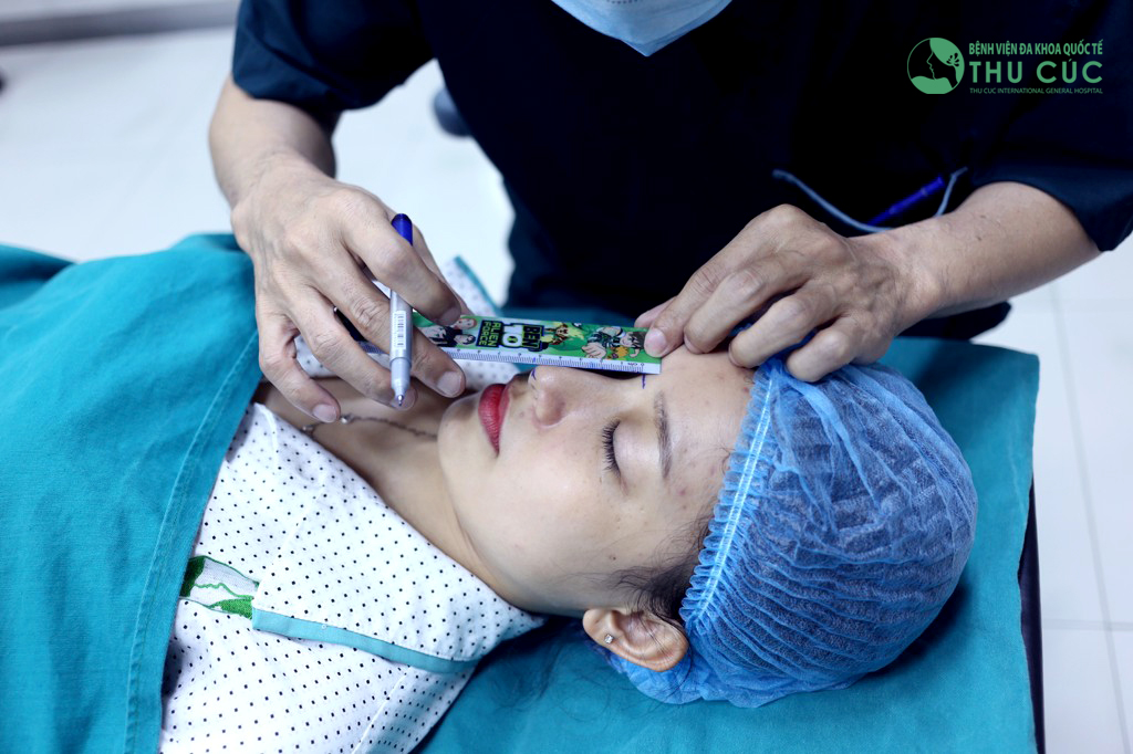 Địa chỉ nâng mũi Hàn Quốc đẹp nhất tại TP.HCM