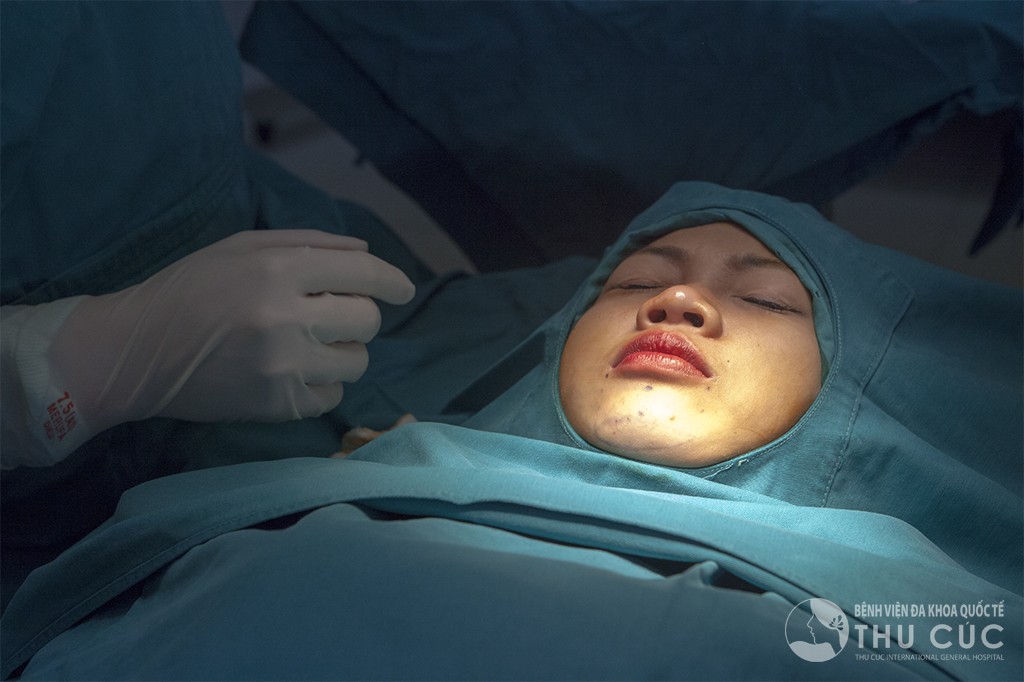 Độn cằm có đau không