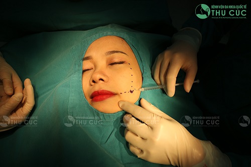 Quy trình tạo má lúm an toàn, nhẹ nhàng và không để lại sẹo thẩm mỹ