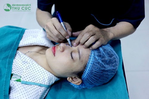 Bác sĩ đo vẽ để xác định hình dáng và kích thước mũi sau khi nâng sao cho hài hòa với đường nét khuôn mặt.
