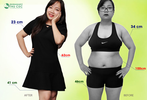 “Dương Panda” ngày nào giờ chỉ còn 50 kg với các chỉ số trên cơ thể hài hòa, cân đối và thon gọn. Chắc hẳn đây là ước mơ của không ít các cô gái. (Lưu ý: Kết quả thẩm mỹ có thể khác nhau tùy thuộc cơ địa từng người)