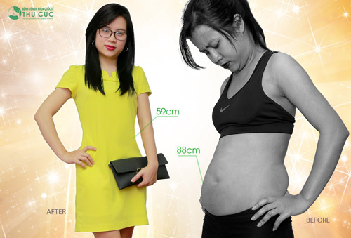 Vòng eo 59cm của chị Thanh Hoa giờ đây đâu có kém Ngọc Trinh là mấy! Eo thon bụng phẳng giúp nữ kế toán 8X tự tin và thành công hơn trong cuộc sống (Lưu ý: Kết quả có thể khác nhau tuỳ cơ địa của từng người ).