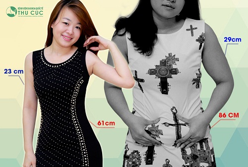 Vòng eo giảm 25 cm, cánh tay giảm 6 cm không còn là niềm mơ ước của bất kỳ bà mẹ bỉm sữa nào với công nghệ Vaser Lipo tại Thu Cúc. (Lưu ý: kết quả còn tùy thuộc vào cơ địa của mỗi người)