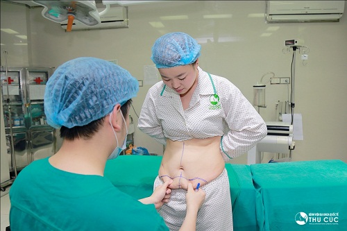 Lượng mỡ thừa được khoanh vùng để hút mỡ chính xác, không xâm lấn các vùng khác