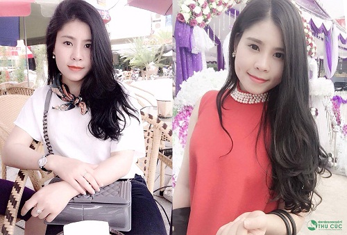 Lê Hơn cũng không hề ngần ngại khi chia sẻ sự thay đổi sau khi tạo má lúm và địa chỉ thẩm mỹ uy tín cùng bạn bè (Lưu ý: Kết quả có thể khác nhau tuỳ cơ địa của từng người ).