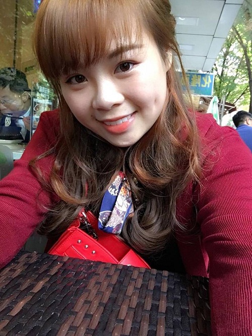 Nụ cười xinh hút hồn của cô bạn Phương Dung sau thẩm mỹ tạo má lúm tại Thu Cúc.