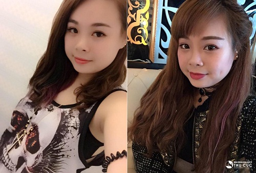 Có một sự lột xác “không hề nhẹ” của cô bạn 9X sau thẩm mỹ tạo má lúm