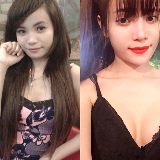 Kết quả thẩm mỹ thành công đã đem đến cho Vivi An một vẻ bề ngoài vô cùng khác biệt. (Kết quả thẩm mỹ có thể khác nhau tùy theo cơ địa từng người).