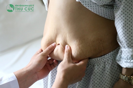 Thông qua thăm khám tình trạng mỡ thừa, bác sĩ đã tư vấn cho Đàm Mai phương pháp hút mỡ bằng công nghệ Vaser Lipo hiện đại kết hợp với tạo hình thành bụng eo thon.