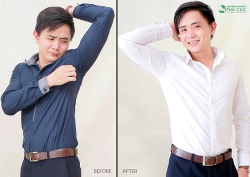 Không lựa chọn thay đổi ngoại hình, Quang Huy đã thực hiện hút tuyến mồ hôi bằng Vaser Lipo để loại bỏ mùi cơ thể khó chịu. Không còn rào cản mỗi khi tiếp xúc với đối tác, đồng nghiệp, Huy dễ dàng thăng tiến, gặt hái nhiều thành công trong sự nghiệp.