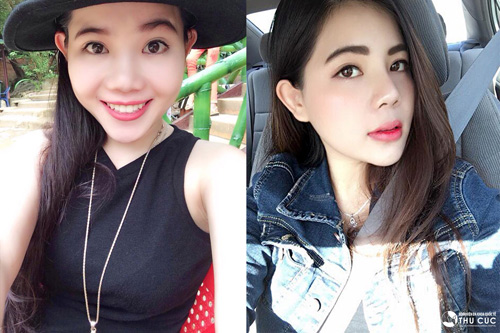 “Về nước thực hiện nâng mũi tại Thu Cúc có thể coi là một trong những quyết định sáng suốt nhất của mình. Dáng mũi thon cao tự nhiên không chỉ giúp mình thêm xinh đẹp, tự tin mà sự nghiệp kinh doanh nhà hàng cũng gặp nhiều thuận lợi” – Quỳnh Đăng (Việt Kiều Mỹ) chia sẻ. (Lưu ý: Hiệu quả thẩm mỹ có thể khác nhau tùy theo cơ địa mỗi người)