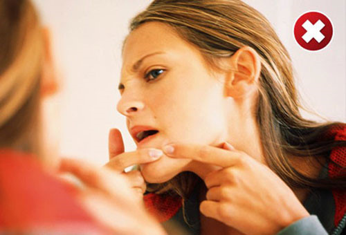 5 nguyên tắc ngăn ngừa sẹo mụn mỗi bạn gái cần biết