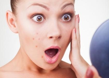 Làn da có thể bị nổi mụn hoặc ngứa ngáy nếu lựa chọn sai phương pháp trị tàn nhang