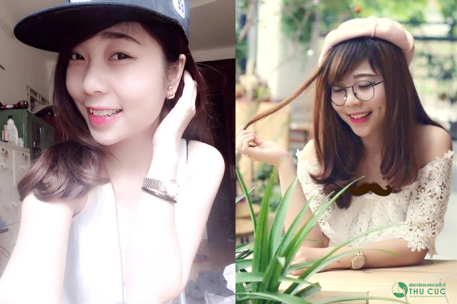 9x Nguyễn Hạnh tạo má lúm, tân trang nhan sắc đón xuân
