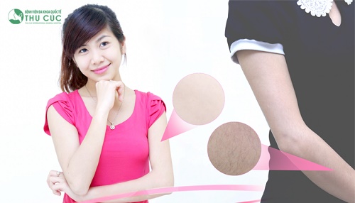 công thức tủ cho nàng rậm lông