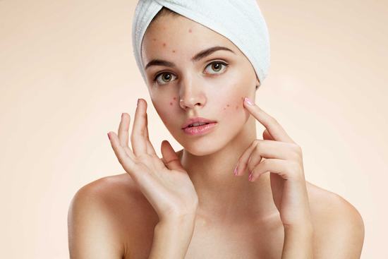 Thay vì đến các thẩm mỹ viện, nhiều người chọn cách tự trị sẹo sau mụn ngay tại nhà.