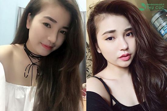 Là biểu tượng của sự sexy nên kể từ khi ra đời, tạo hình môi trái tim luôn được đông đảo chị em hưởng ứng. Cô bạn Phạm Hồng Nhung (23 tuổi) đã nhanh chóng bắt kịp trào lưu và thực hiện dịch vụ này tại Thu Cúc Sài Gòn. (Lưu ý: Kết quả có thể khác nhau tùy cơ địa từng người)