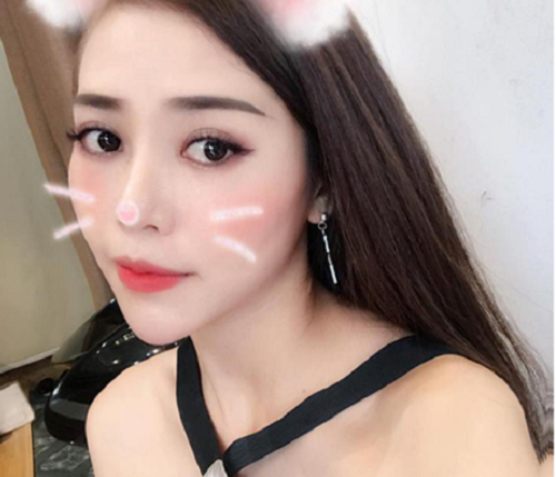 Là một trong những tín đồ làm đẹp, cô bạn Hà Anh (SN 1988) đã nhanh chóng thực hiện dịch vụ hot này tại Thu Cúc Sài Gòn