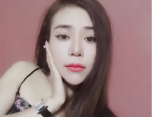 Theo các bác sĩ tại Thu Cúc Sài Gòn, tạo môi trái tim là một tiểu phẫu nhỏ, tuy nhiên nếu thực hiện ở cơ sở thẩm mỹ không uy tín, bác sĩ chuyên môn kém sẽ có thể xảy ra một số biến chứng như môi không cân xứng, nhiễm trùng… Chính vì vậy bạn nên tìm hiểu kỹ trước khi lựa chọn địa chỉ làm đẹp.