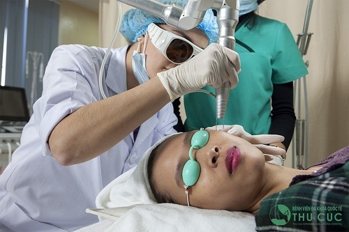 Tại Thu Cúc, nám da được loại bỏ hiệu quả với công nghệ Laser YAG.