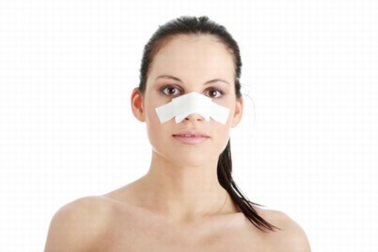 Mức độ sưng, thời gian sưng bao lâu sau nâng mũi còn phụ thuộc vào cơ địa và cách chăm sóc của khách hàng