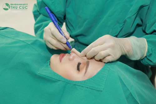 Chất liệu sử dụng ảnh hưởng quyết định đến dáng mũi sau phẫu thuật