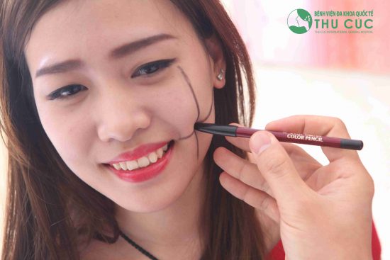 Các bác sĩ tài hoa tại Thu Cúc sẽ giúp bạn sở hữu chiếc má lúm đẹp tự nhiên
